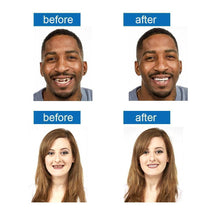 Load image into Gallery viewer, Magic Smile Teeth Brace