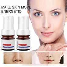 Load image into Gallery viewer, Vitamin C Whitening Freckles Face Cream