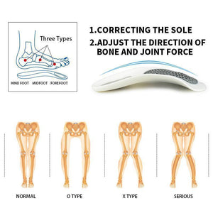 Foot Orthotics Plantar Fasciitis Arch Support Insoles