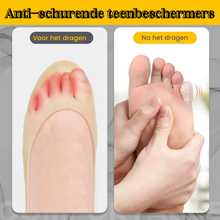 Load image into Gallery viewer, Silicone anti-friction toe protector