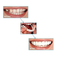 Load image into Gallery viewer, Magic Smile Teeth Brace