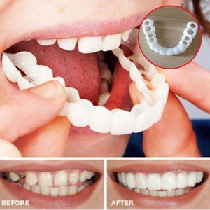 Magic Smile Teeth Brace