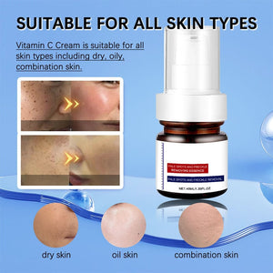 Vitamin C Whitening Freckles Face Cream